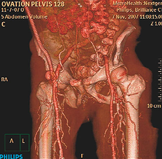 Illustration for article titled Brilliance CT 256-Slice Scanner from Philips Gets to the Heart of the Problem